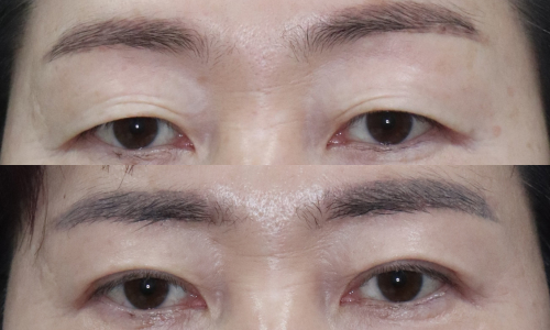 슬라이드32